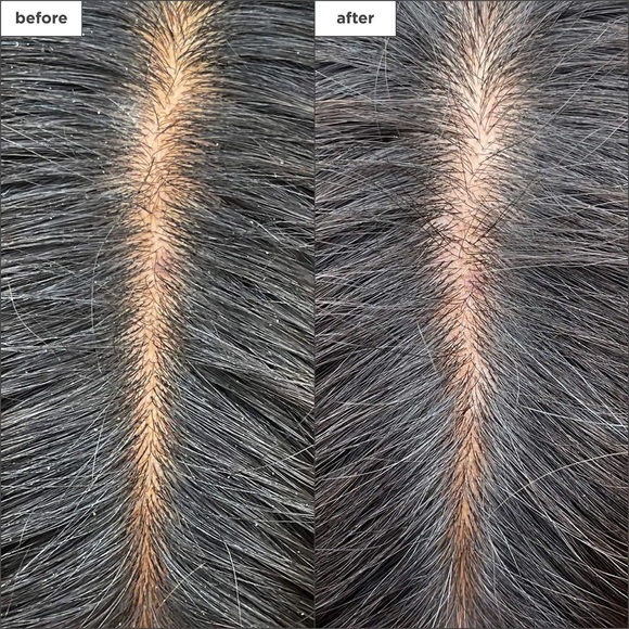 Briogeo Scalp Revival Charcoal + Tea Tree Cooling Hydration Mask Full Size - Picture 2 of 6